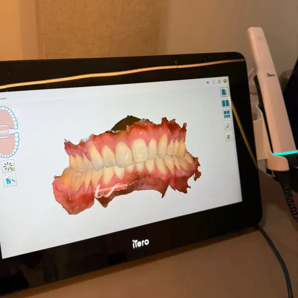 clinica iluminart (5) copy